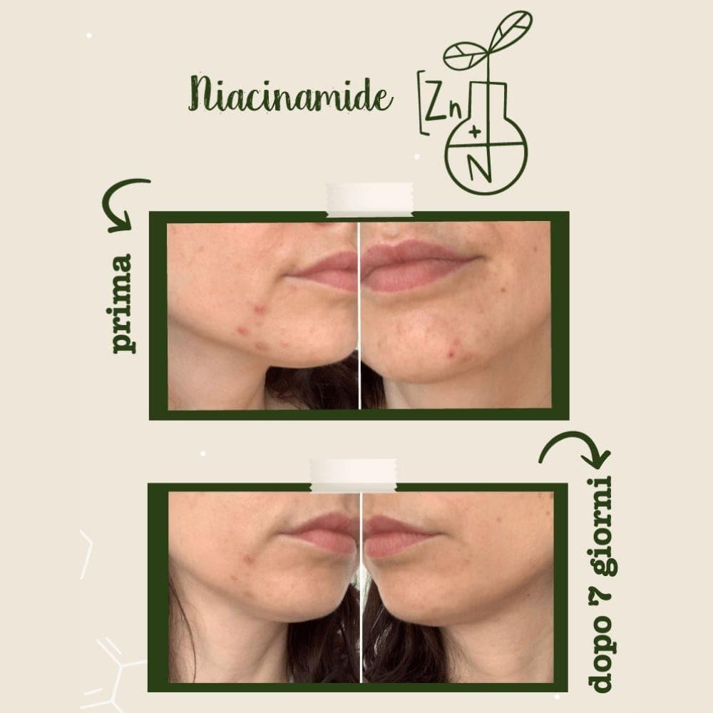 Niacinamide e zinco Attivi Puri, 30 ml - La Saponaria
