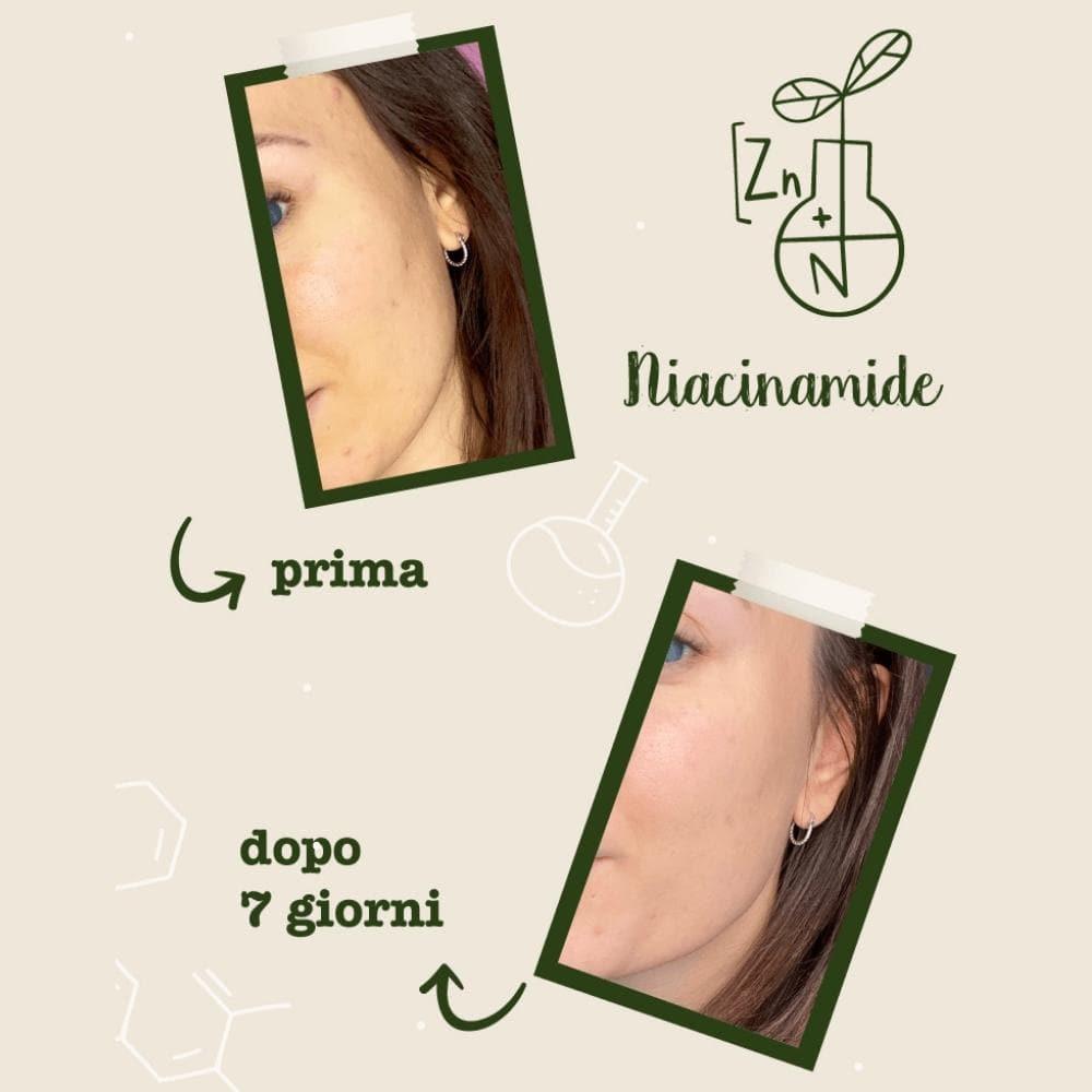 Niacinamide e zinco Attivi Puri, 30 ml - La Saponaria