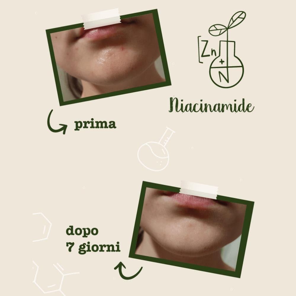 Niacinamide e zinco Attivi Puri, 30 ml - La Saponaria