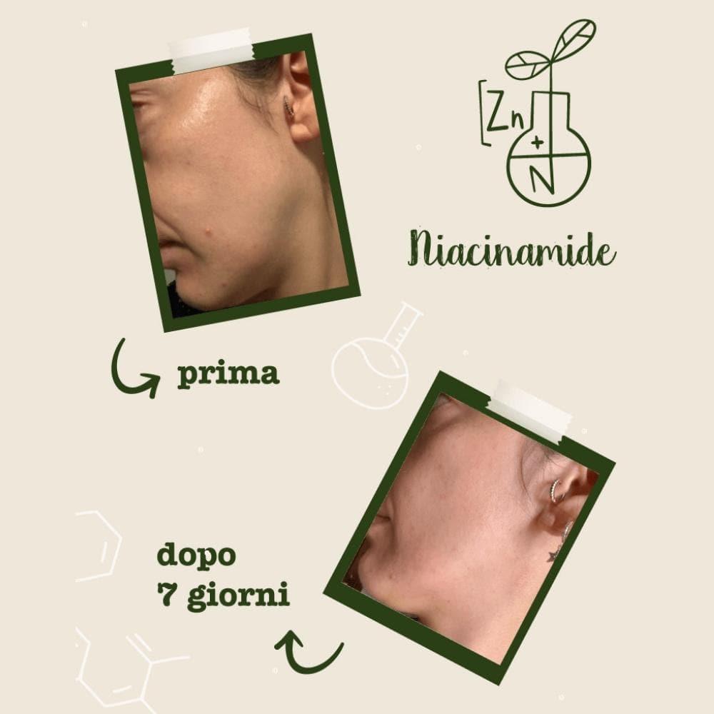 Niacinamide e zinco Attivi Puri, 30 ml - La Saponaria